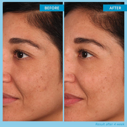 Multi-Acid Resurfacing Pads - Limited Time Offer - 30% OFF