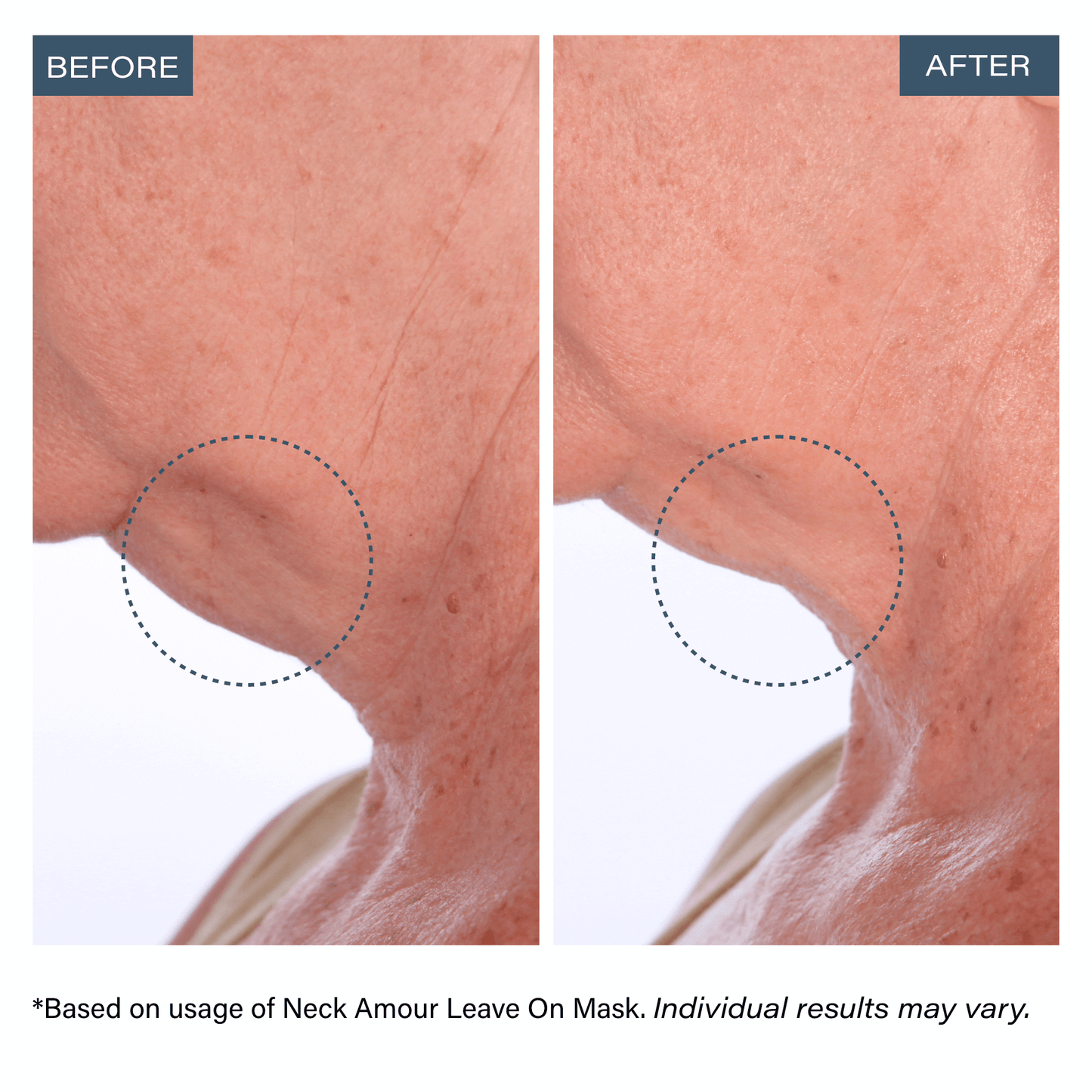 Advanced Leave-On Mask + Serum