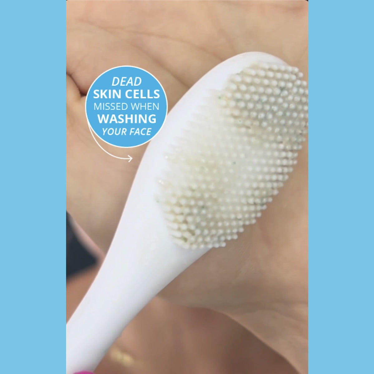 DermAppeal® Microdermabrasion Treatment - Limited Time Offer