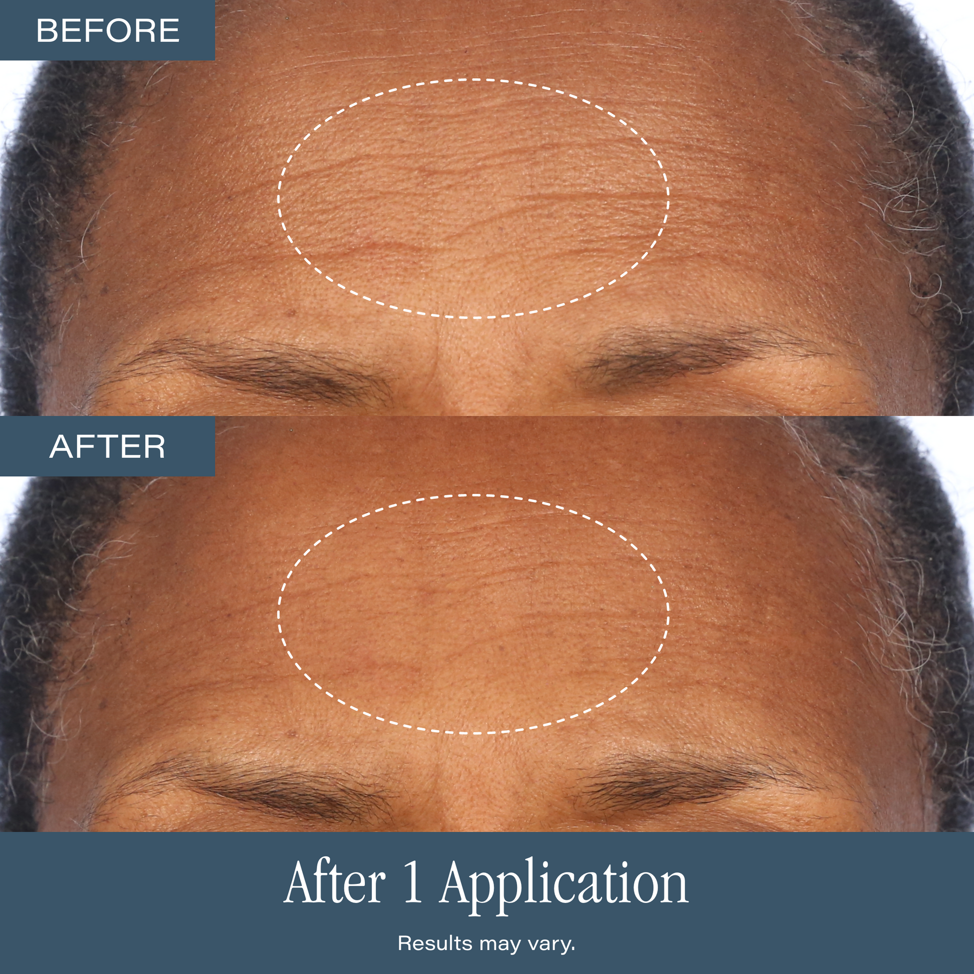 SKINN Skip the Derm Duo - NEW LOOK