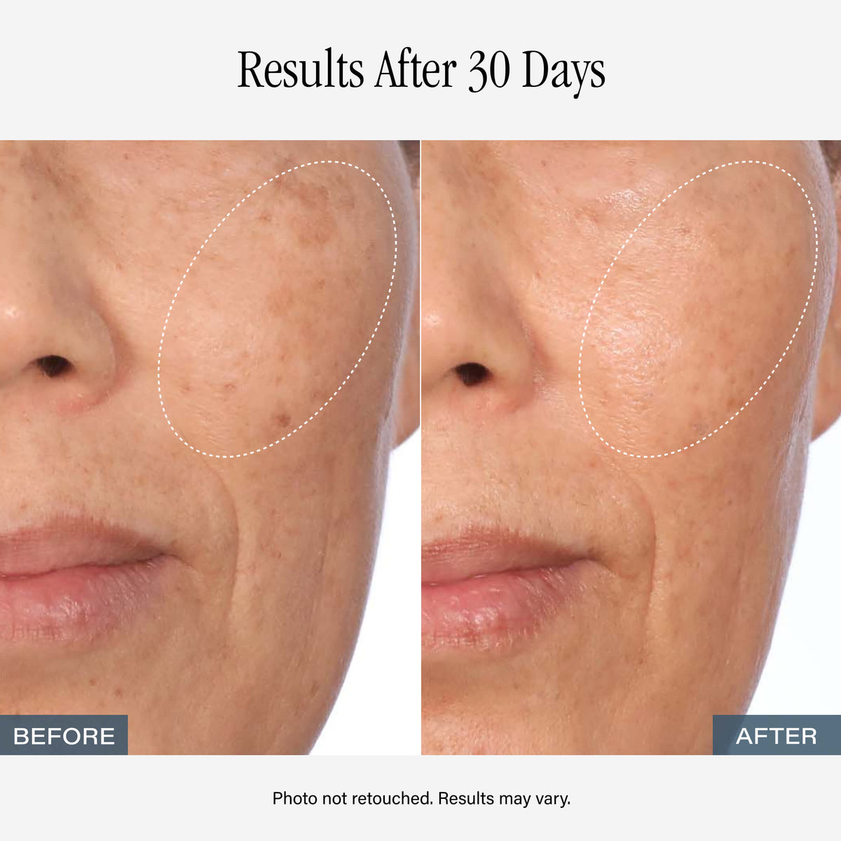 SKINN Vitamin C Serum