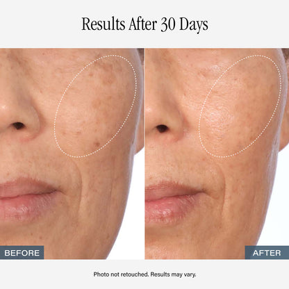 SKINN Vitamin C Serum