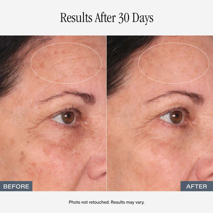 SKINN Vitamin C Serum