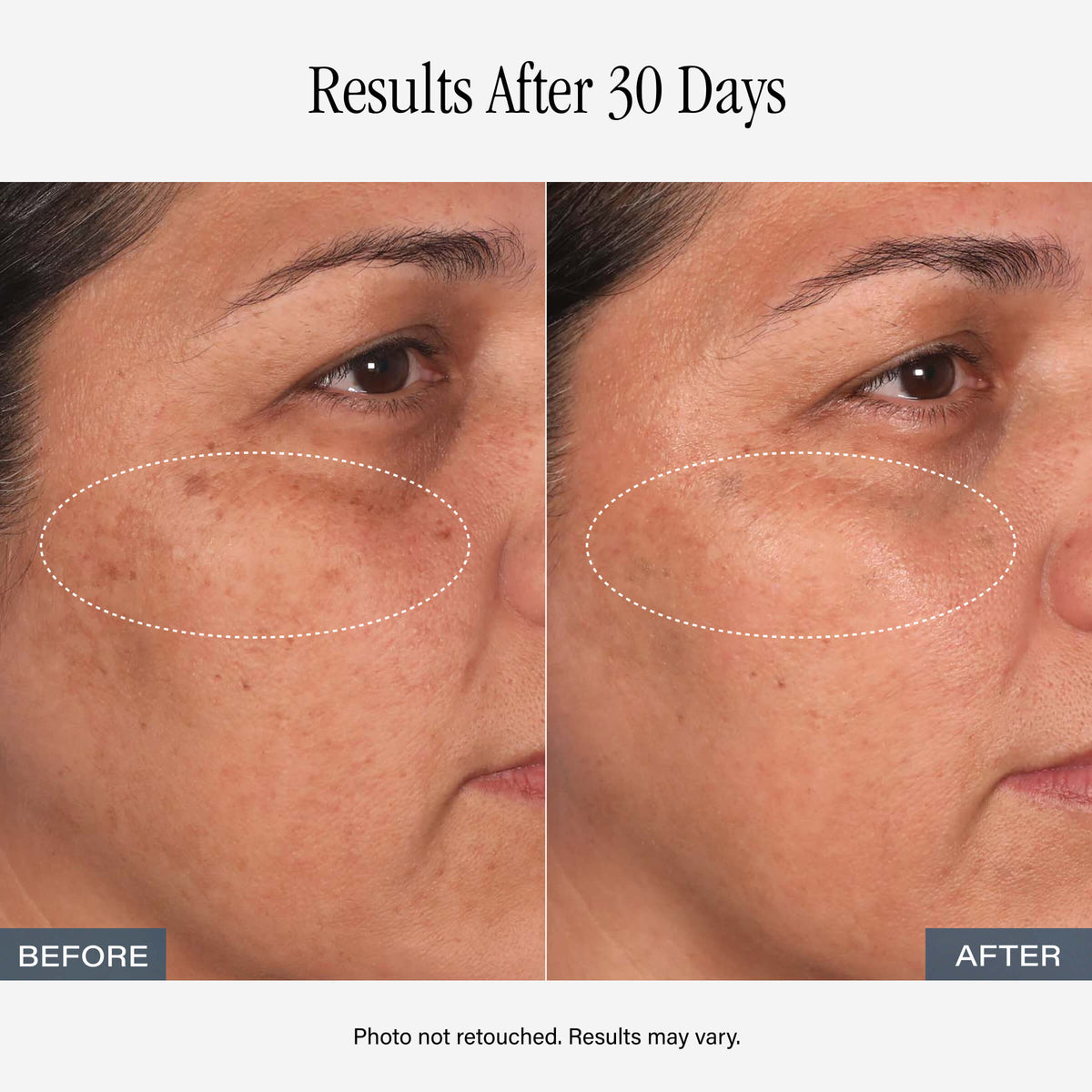 SKINN Vitamin C Serum
