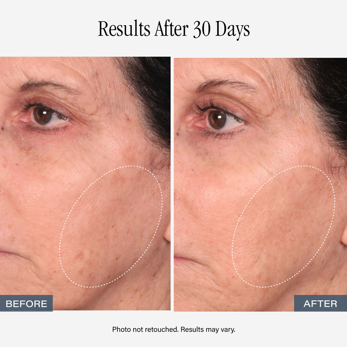 SKINN Vitamin C Serum