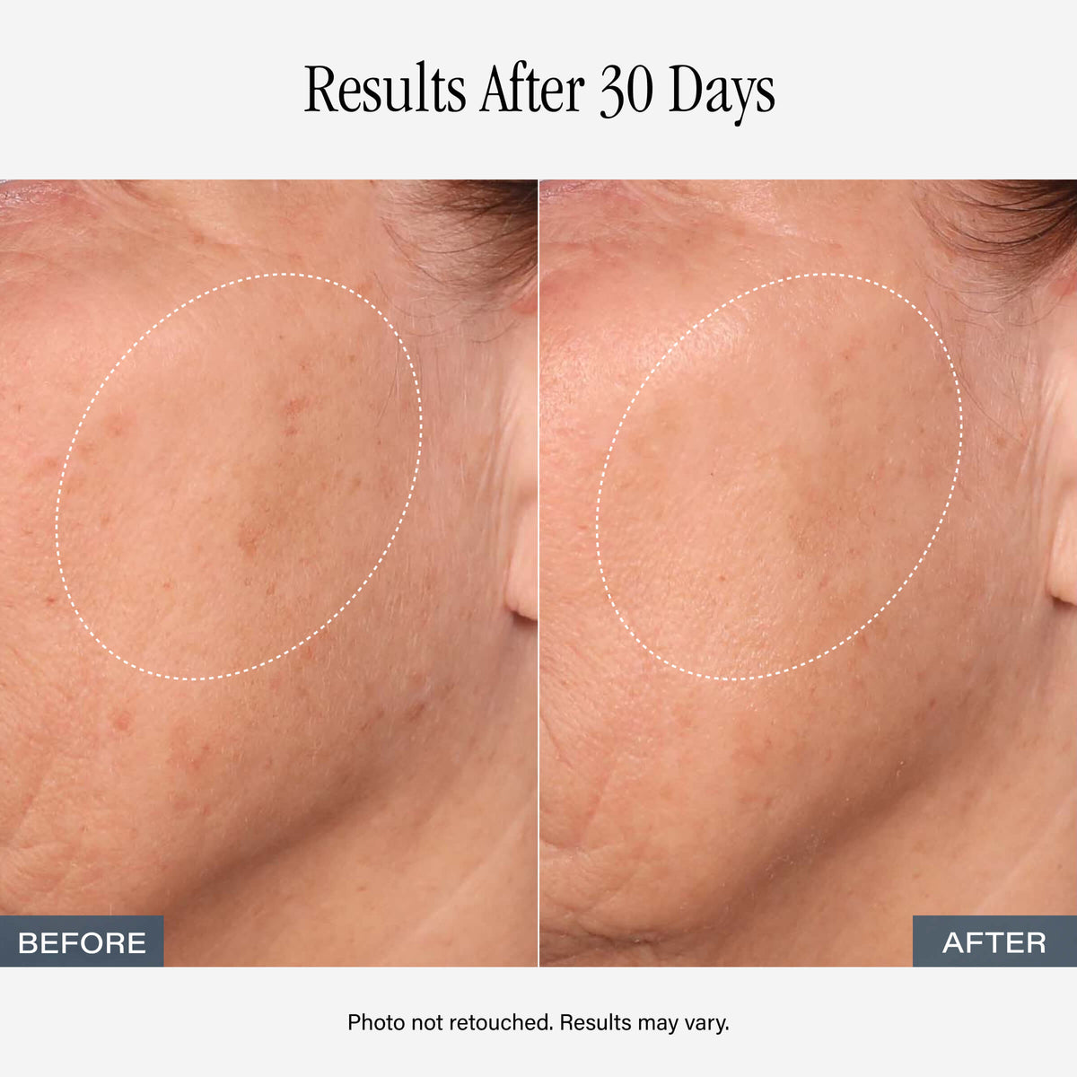 SKINN Vitamin C Serum