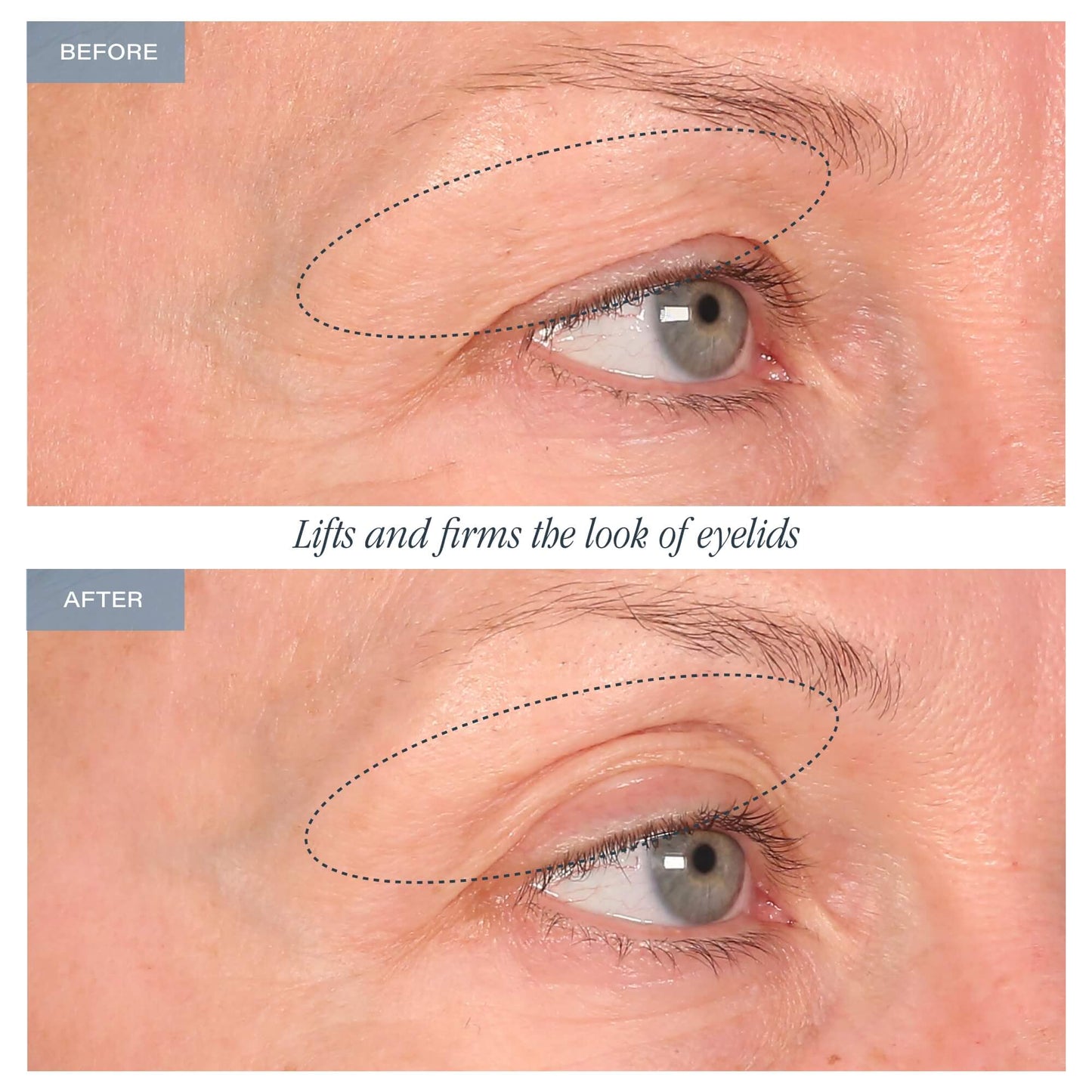 30-Day Eye Boot Camp™ - Limited Time Offer