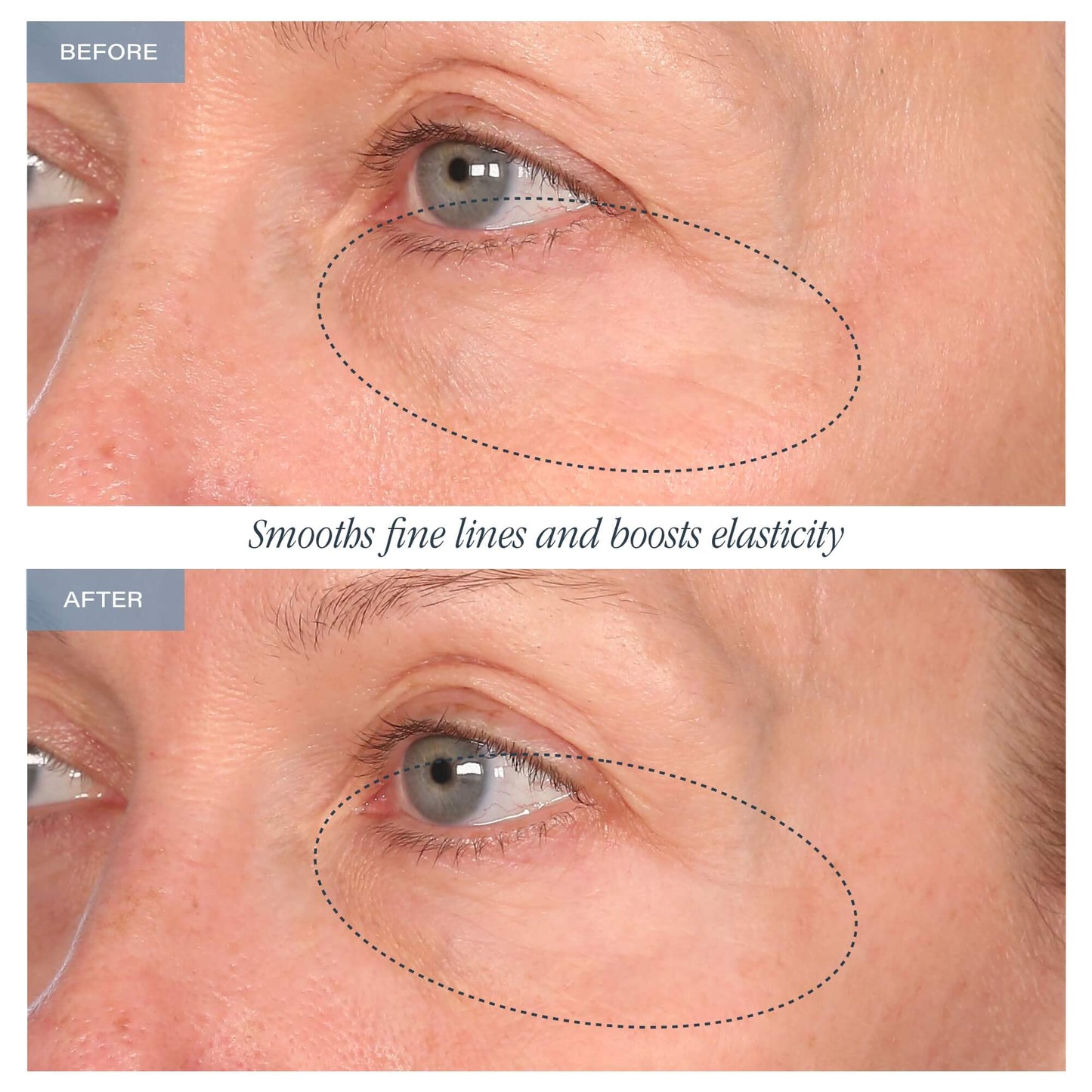 30-Day Eye Boot Camp™ - Limited Time Offer