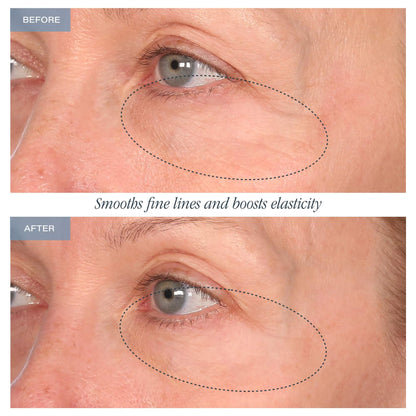 30-Day Eye Boot Camp™ - Limited Time Offer