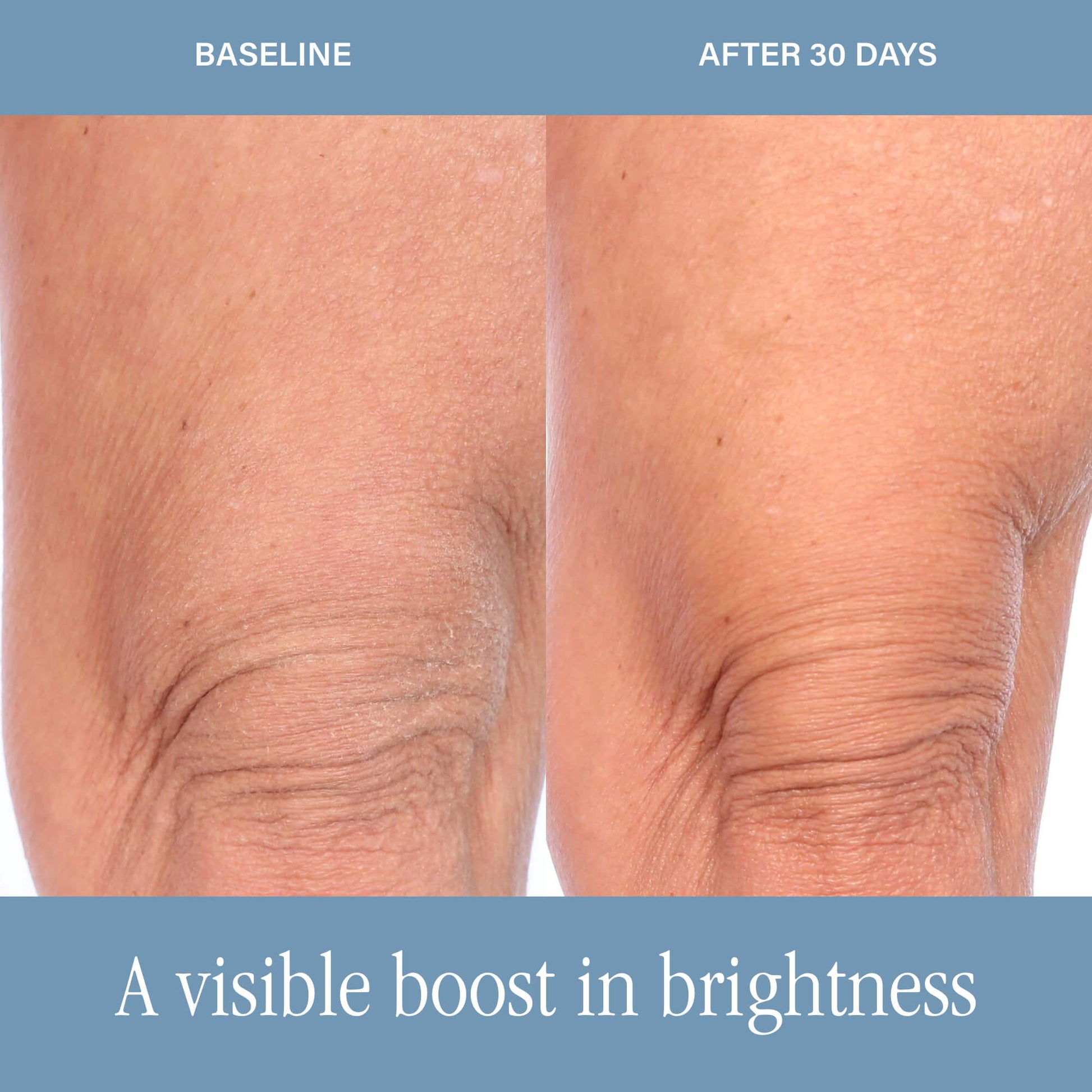 SKINN DermAppeal® Body