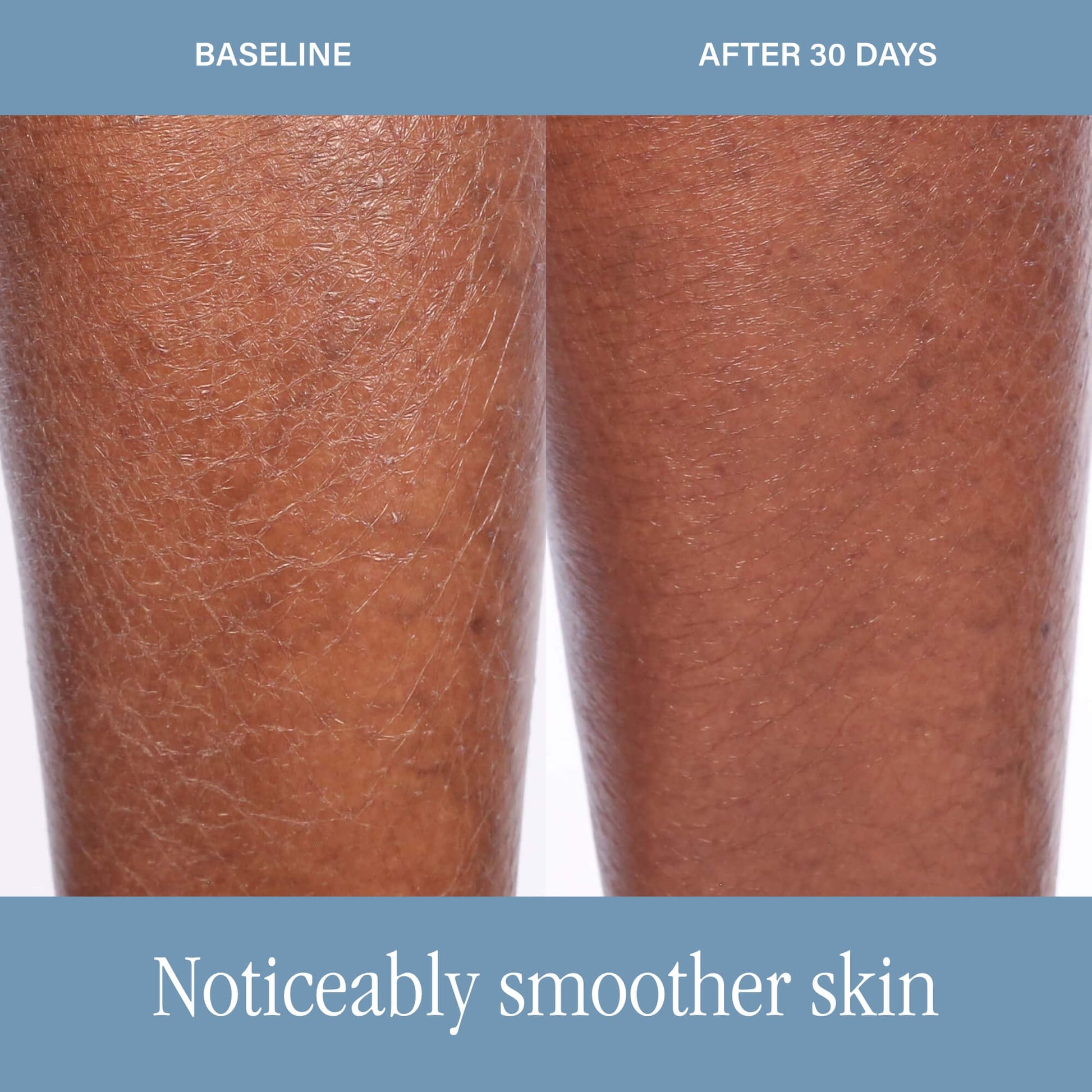 SKINN DermAppeal® Body