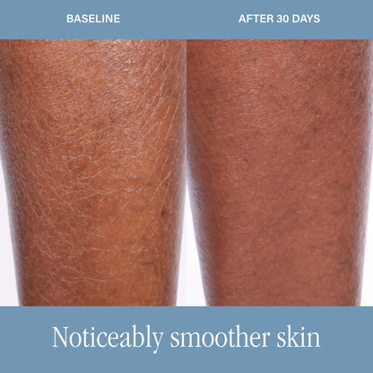 SKINN DermAppeal® Body