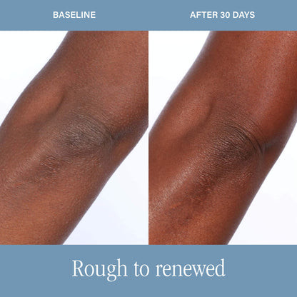 SKINN DermAppeal® Body