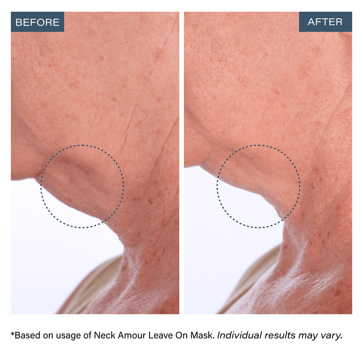 Advanced Leave-On Mask – SKINN