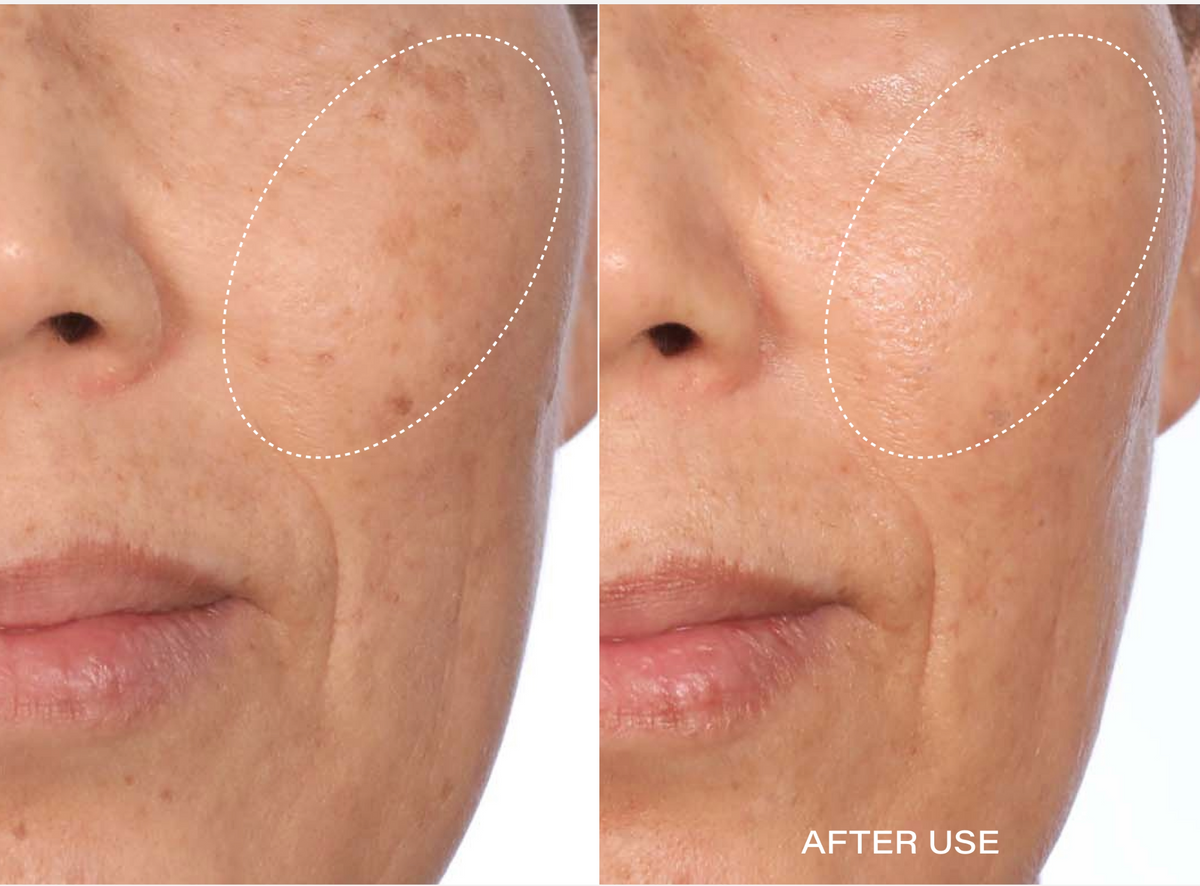 Before and after result