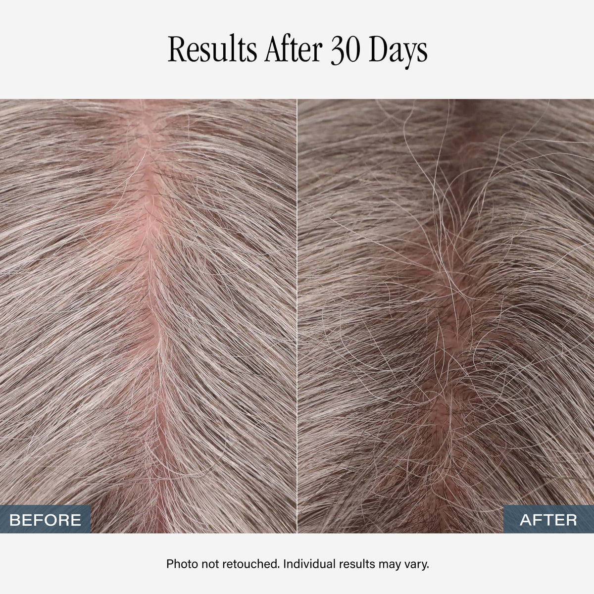 SKINN Amplifying Root Ritual Scalp Serum