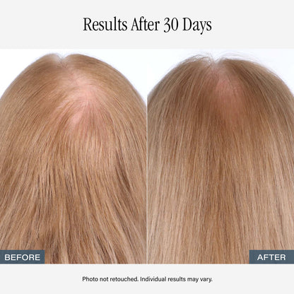 SKINN Amplifying Root Ritual Scalp Serum