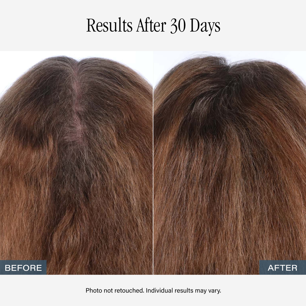SKINN Amplifying Root Ritual Scalp Serum