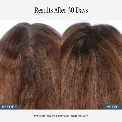 SKINN Amplifying Root Ritual Scalp Serum