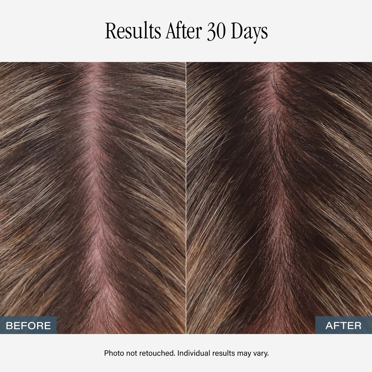 SKINN Amplifying Root Ritual Scalp Serum
